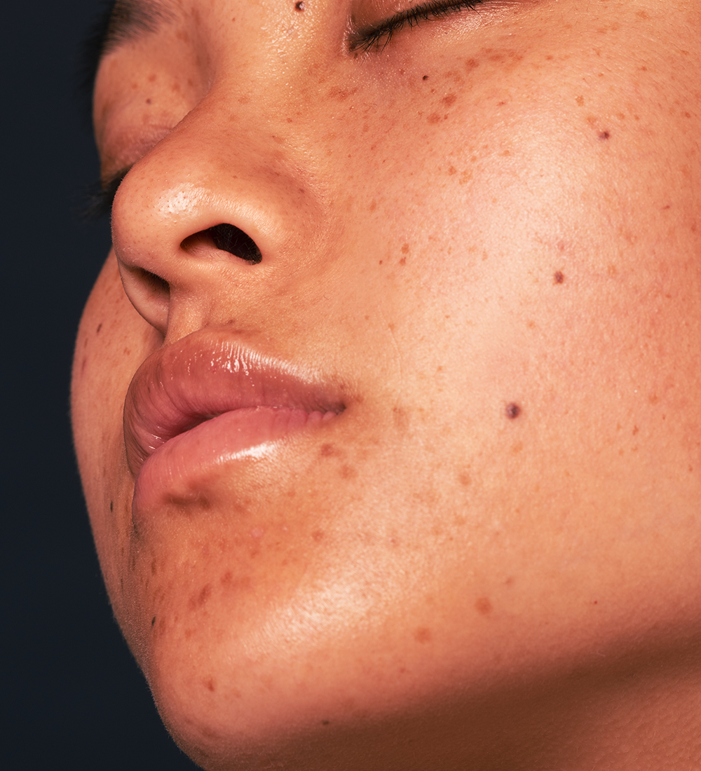 botox-scaled-r3x4c1gk98q8vjyk2qmxxtqpi56h8ha1fy0